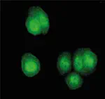 NF-κB Signalling dynamics in health and disease