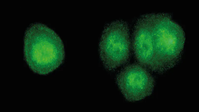 NF-κB Signalling dynamics in health and disease